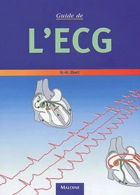 Guide De L'Ecg