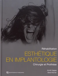 Réhabilitation esthétique en implantologie