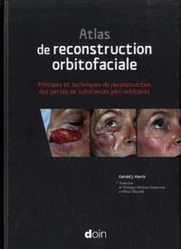 Atlas de reconstruction oculofaciale
