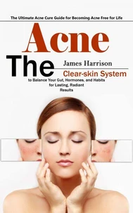 Acne: The Ultimate Acne Cure Guide for Becoming Acne Free for Life (The Clear-skin System to Balance Your Gut, Hormones, and Habits for Lasting, Radiant Results)