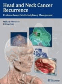 Head and Neck Cancer Recurrence - Evidence-based, Multidisciplinary Management.