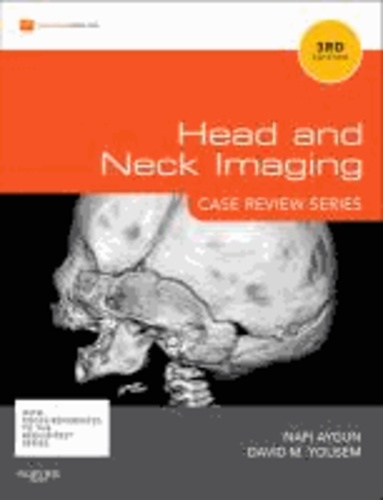 Head and Neck Imaging.