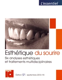 Esthétique du sourire
