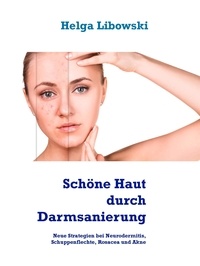Helga Libowski - Schöne Haut durch Darmsanierung - Neue Strategien bei Neurodermitis, Schuppenflechte, Rosacea und Akne.