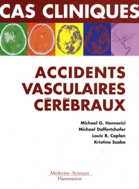 Cas cliniques : accidents vasculaires cérébraux