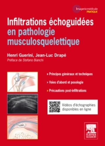 Infiltrations échoguidées en pathologie musculosquelettique