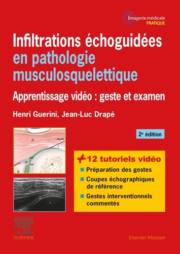 Henri Guerini et Jean-Luc Drapé - Infiltrations échoguidées en pathologie musculosquelettique - Apprentissage vidéo : geste et examen.
