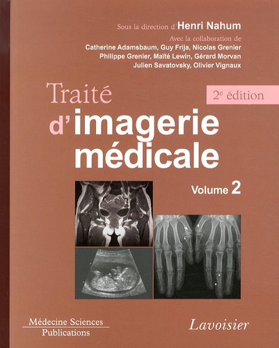Traité d'imagerie médicale. Volume 2 2e édition