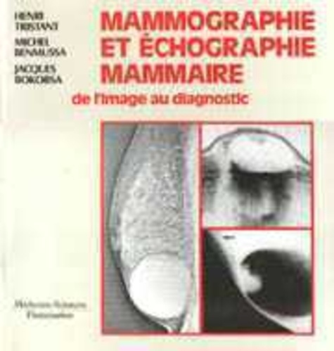 Henri Tristant et Michel Benmussa - Mammographie et échographie mammaire - De l'image au diagnostic.