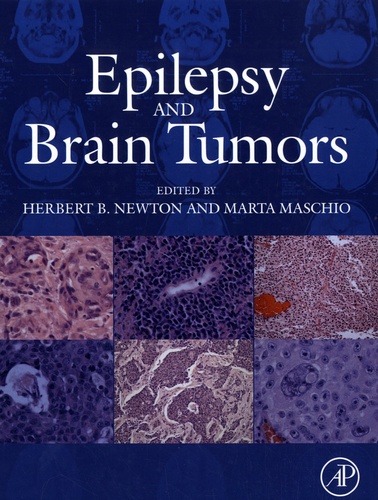 Herbert B. Newton et Marta Maschio - Epilepsy and Brain Tumors.