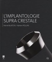 Hervé Buatois et Adrien Pollini - L'implantologie supracrestale.