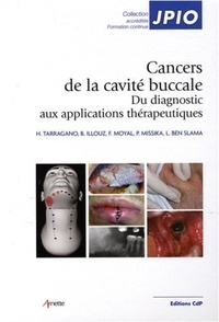 Hervé Tarragano et Benjamin Illouz - Les cancers de la cavité buccale - Du diagnostic aux applications thérapeutiques.
