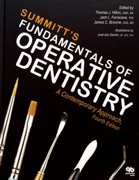 Summitt's Fundamentals of Operative Dentistry