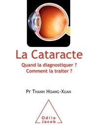 Cataracte (La)