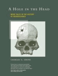 Hole in the Head - More Tales in the History of Neuroscience.