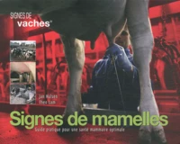 Signes de mamelles