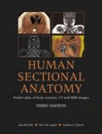 Human Sectional Anatomy: Pocket Atlas of Body Sections, CT and MRI Images - Pocket Atlas of Body Sections, CT and MRI Images.