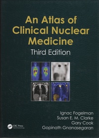 Ignac Fogelman et Susan-E-M Clarke - An Atlas of Clinical Nuclear Medicine.