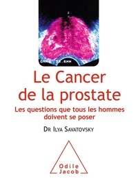 Le cancer de la prostate - Les questions que tous les hommes doivent se poser.pdf