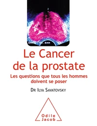 Le cancer de la prostate