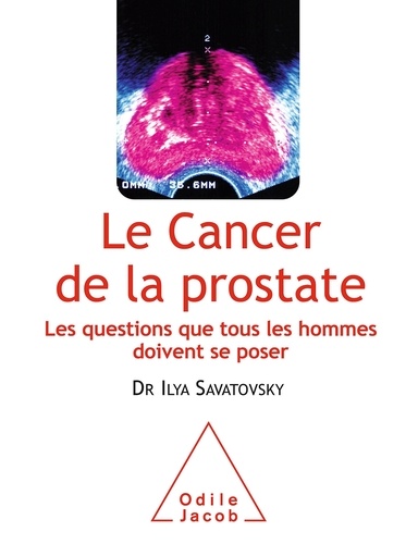 Le cancer de la prostate. Les questions que tous les hommes doivent se poser