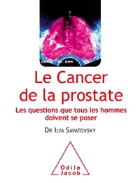 Le cancer de la prostate