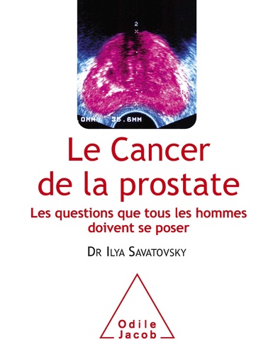 Le cancer de la prostate. Les questions que tous les hommes doivent se poser