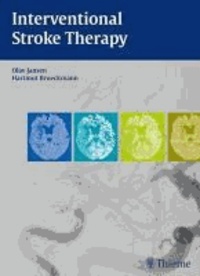 Interventional Stroke Therapy.