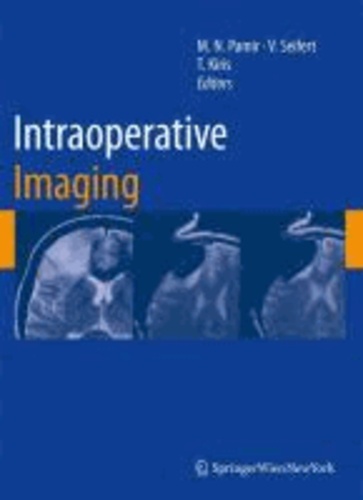Intraoperative Imaging.