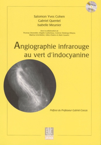 Isabelle Meunier et  Collectif - Angiographie infrarouge au vert d'indocyanine. - Avec CD-ROM.