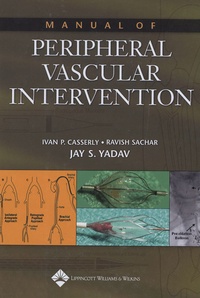 Ivan P Casserly et Ravish Sachar - Manual of peripheral vascular Intervention.