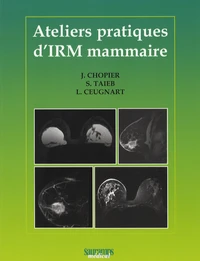 Ateliers Pratiques d'IRM Mammaire