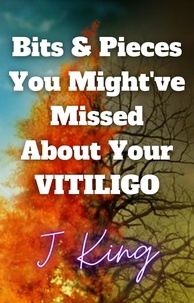 Téléchargements de livres électroniques gratuits au format txt Bits & Pieces You Might've Missed About Your Vitiligo CHM 9798215328934 in French par J King