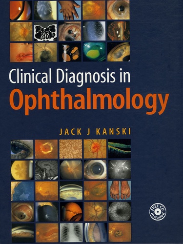 Jack-J Kanski - Clinical Diagnosis in Ophtalmology. 1 Cédérom