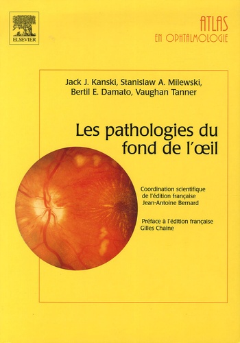 Jack-J Kanski et Stanislaw-A Milewski - Les pathologies du fond de l'oeil.