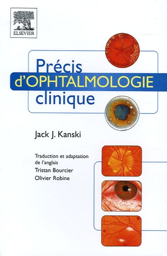 Jack-J Kanski - Précis d'ophtalmologie clinique.