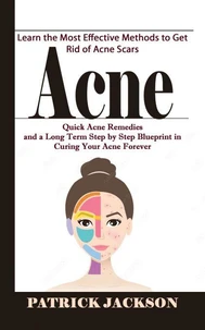 Acne: Learn the Most Effective Methods to Get Rid of Acne Scars (Quick Acne Remedies and a Long Term Step by Step Blueprint in Curing Your Acne Forever)
