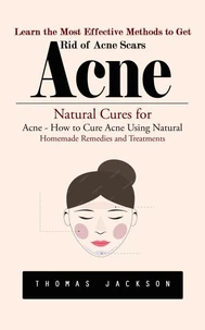 Acne: Learn the Most Effective Methods to Get Rid of Acne Scars (Natural Cures for Acne - How to Cure Acne Using Natural Homemade Remedies and Treatments)