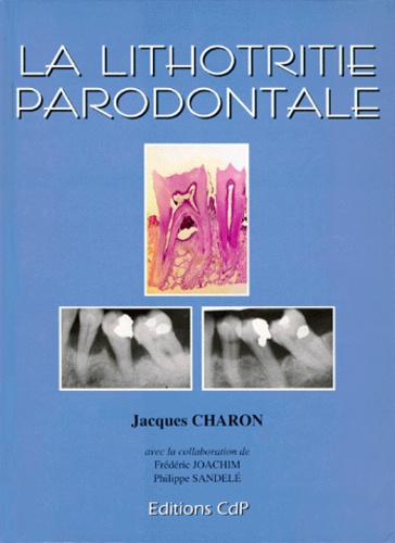 Jacques Charon - La lithotritie parodontale.