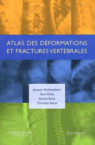 Atlas des déformations et fractures vertébrales