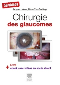 Jacques Laloum et Pierre-Yves Santiago - Chirurgie des glaucomes.