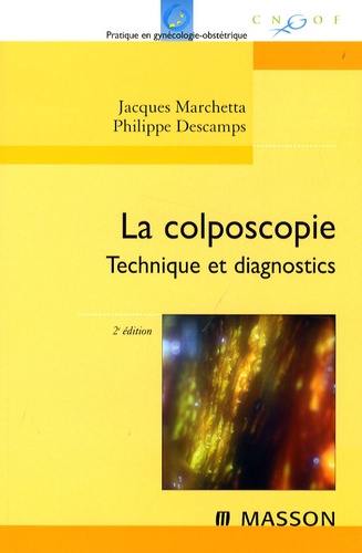 Jacques Marchetta et Philippe Descamps - La colposcopie.