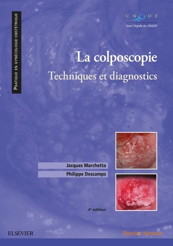 La colposcopie. Techniques et diagnostics 4e édition