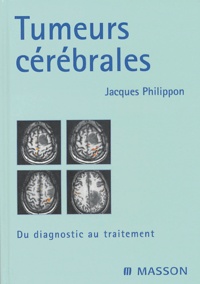 Tumeurs cérébrales - Du diagnostic au traitement.pdf