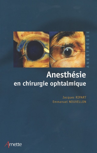 Jacques Ripart et Emmanuel Nouvellon - Anesthésie en chirurgie ophtalmique.