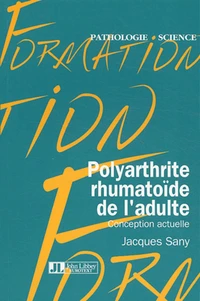 Polyarthrite rhumatoïde de l'adulte : conception actuelle