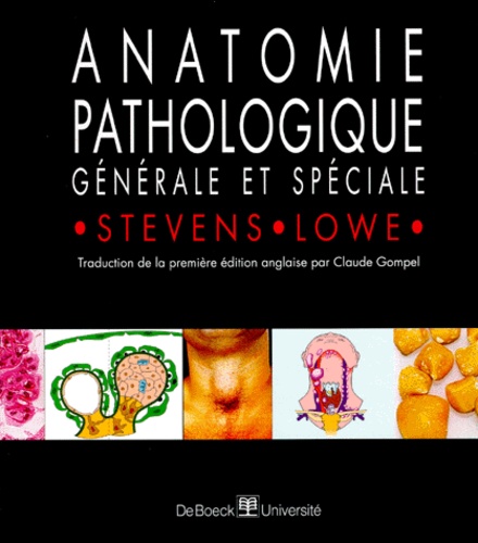 James Lowe et Alan Stevens - Anatomie Pathologique Generale Et Speciale.