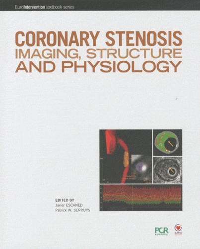 Javier Escaned et Patrick Serruys - Coronary stenosis imaging, structure and physiology.