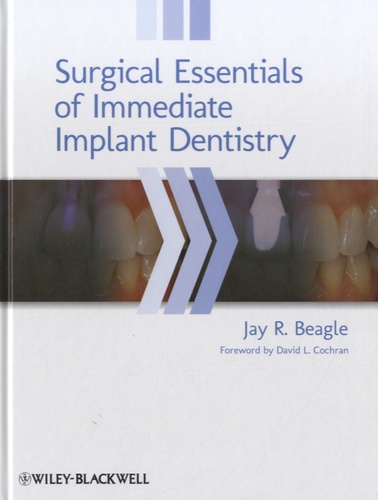 Jay R Beagle - Surgical Essentials of Immediate Implant Dentistry.