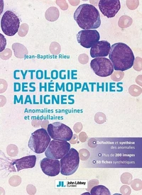 Cytologie des hémopathies malignes